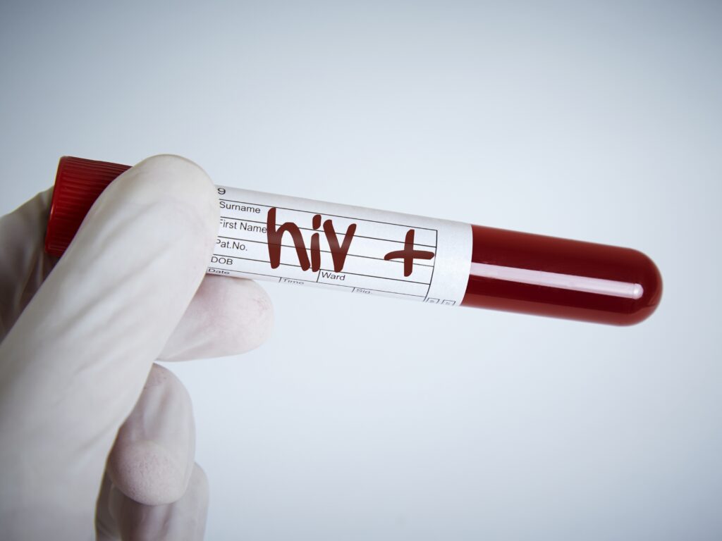 HIV