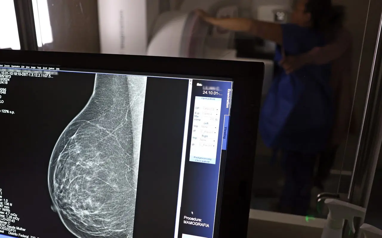 Plano de saúde terá que cobrir mamografia digital para todas as idades