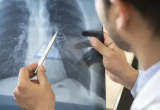 Anvisa aprova novo medicamento para câncer de pulmão avançado